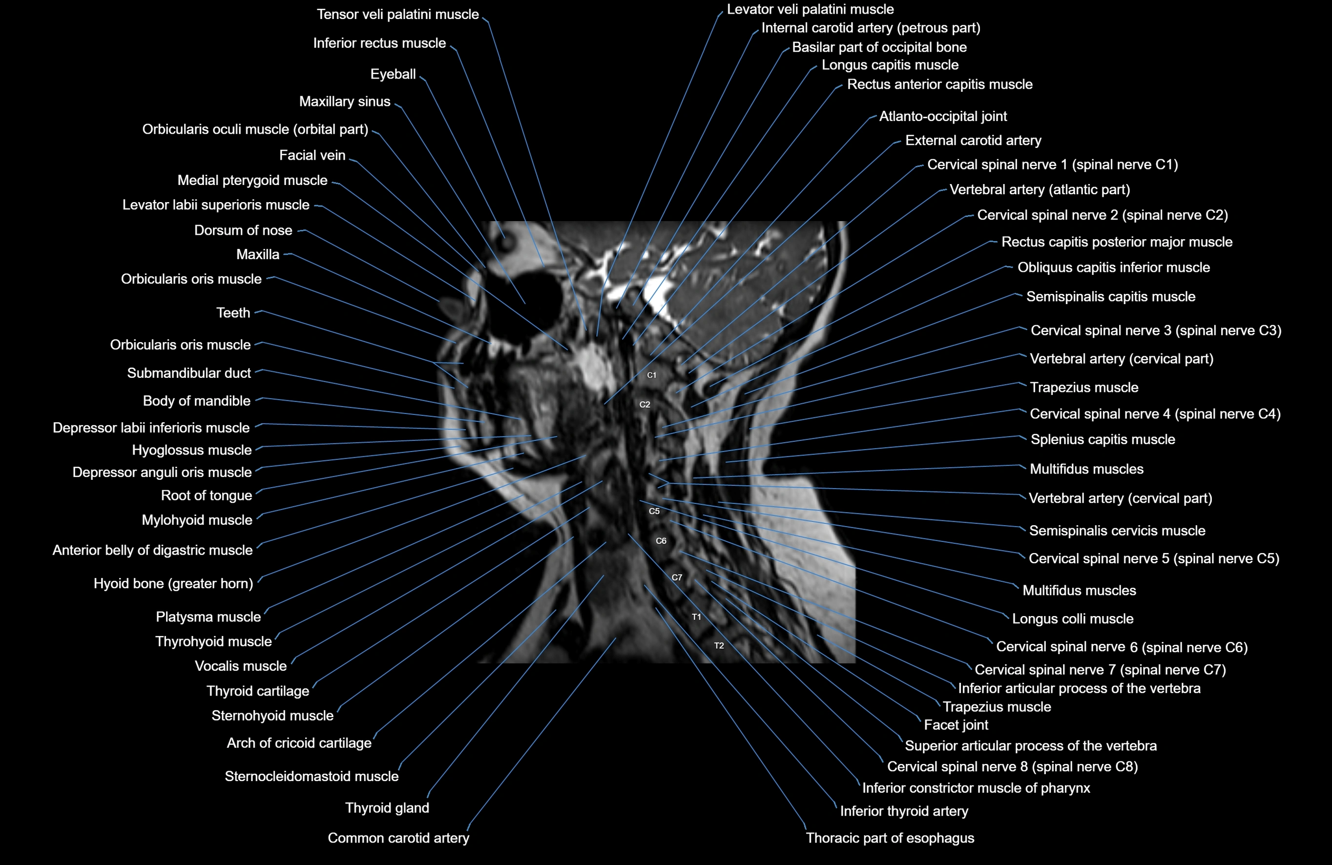Neck MRI sagittal cross sectional anatomy 3D 1mm 3T radiology  image-img-00001-00013.webp